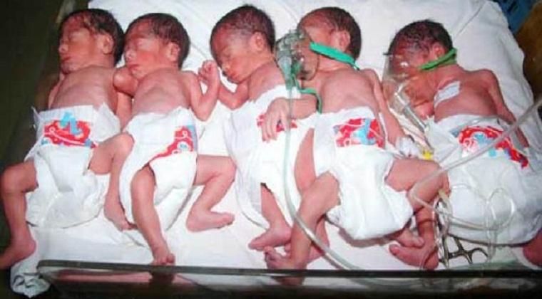 Bayi Kembar Lima