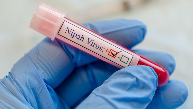 Epidemiolog: Virus Nipah Berpotensi Masuk Indonesia